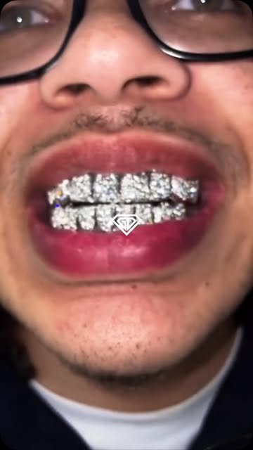 Client avec un grill iced out complet haut et bas