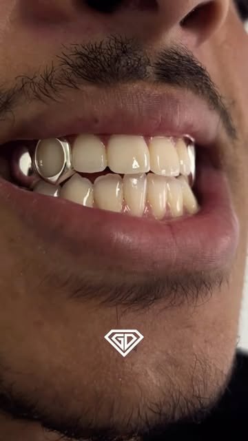 Sourire avec deux dents open face en argent